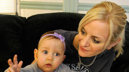 Cami Santee, with her mother, Tami Dobrinski, had surgery to remove the external part of a tumor while part of her body was still in the womb.
