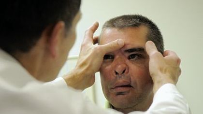 Doug Surowiec's surgeon, Steven Bonawitz, examines his face during an appointment last week at UPMC Presbyterian.