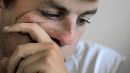 Derrick Earley, 23, of Fulton County, has post-traumatic stress disorder, or PTSD, due to the multiple explosions he survived and the carnage he witnessed as a 19-year-old Marine serving in Iraq.